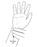 P6针灸点
（相片来源：Anesthesiology 2005；102：1046）