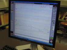 The system assists paralysis patients to write text on a computer by measuring their brain waves