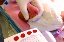 The screening test for IEM requires only a few drops of blood collected by pricking the baby’s heel and the results will be available within a few days.