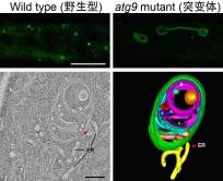 3-D model (right) generated from electron tomography data (left), showing direct connection between the abnormal autophagosomal tubule (green) and the ER membrane (yellow). Scale bar=500nm.