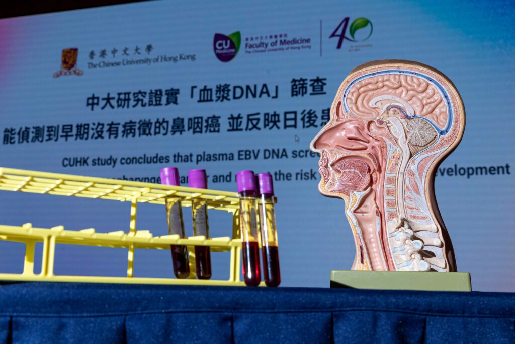 「血漿EB病毒DNA」篩查研究對解釋基於循環腫瘤 DNA 或液體活檢測試具深遠影響，將進一步探討相關的臨床意義。