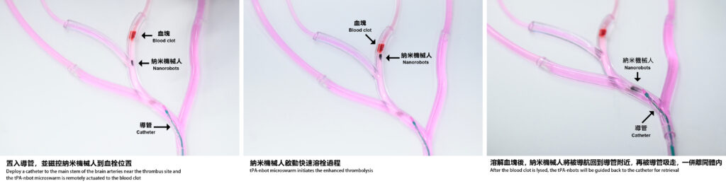 透過將載有tPA-nbot群的導管置入到接近血栓的位置，然後遙控這些納米機械人到達只有亞毫米大小的血管中，瞄準血塊啟動溶栓過程。血塊溶解後，tPA-nbot群將被導航回到導管，一併離開體內。