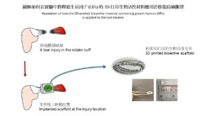 圖解如何在實驗中將釋放生長因子 (GFs) 的 3D 打印生物活性材料應用於修復肩袖撕裂。