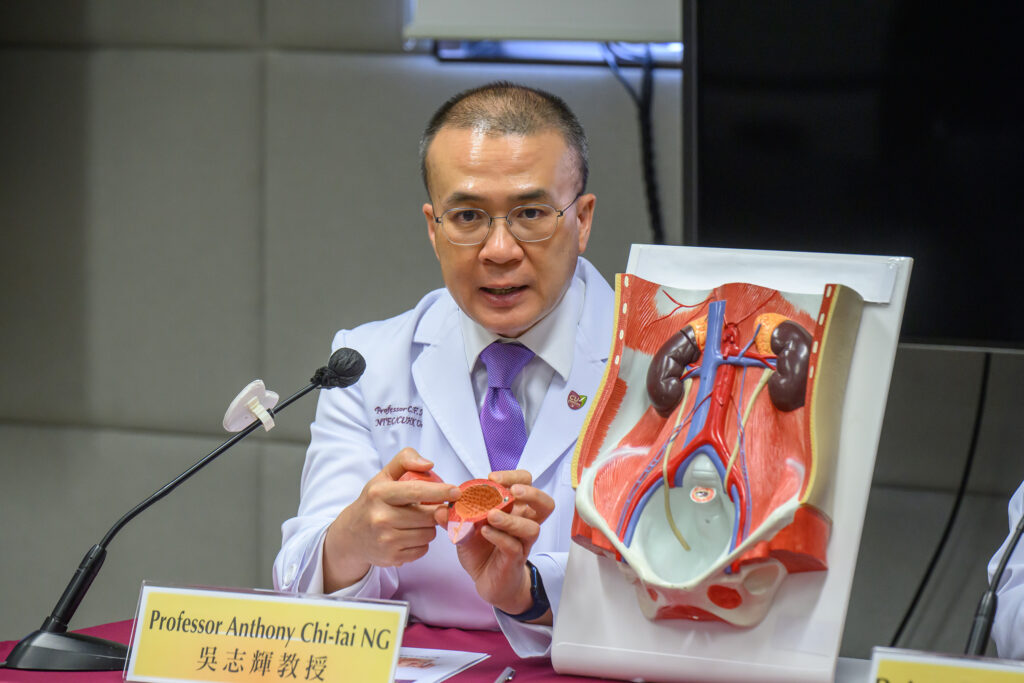 Professor Ng Chi-fai remarks that seriously ill patients with bladder cancer, whose tumours have invaded the muscle layer, may need to remove the whole bladder through traditional surgery.