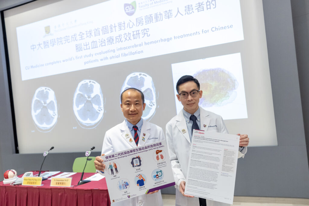 CU Medicine conducted the world’s first population-based study comparing treatments for Chinese patients with atrial fibrillation (AF) who have developed intracerebral hemorrhage. Results showed that among those patients, prothrombin complex concentrate treatment did not significantly improve recovery outcomes compared to conservative treatment, and there is still an urgent need to explore effective treatment for intracerebral hemorrhage patients. <br />
Professor Thomas Leung Wai-hong (left), Lee Quo Wei Professor of Neurology and Head of Division, and Dr Bonaventure Ip Yiu-ming, Assistant Professor from the Division of Neurology at CU Medicine’s Department of Medicine and Therapeutics.