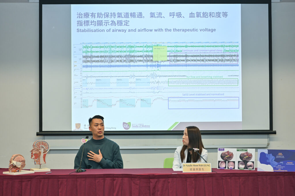 Mr Leung had been suffering from OSA for years without an effective treatment until he received UAS therapy last year. He says it took a short time for him to adapt to the automatic movement of the tongue after surgery. He soon got used to the system and was pleased with the treatment result.